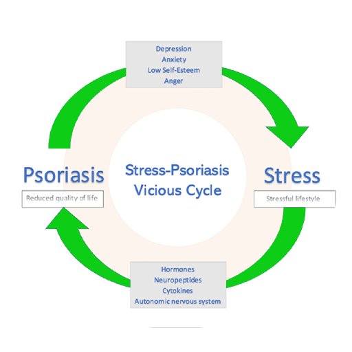 psoriasis treatment
