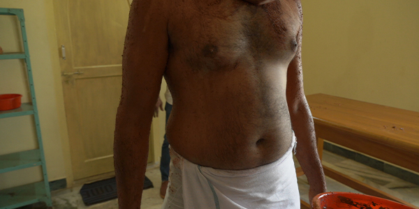 psoriasis treatment hospital chennai
